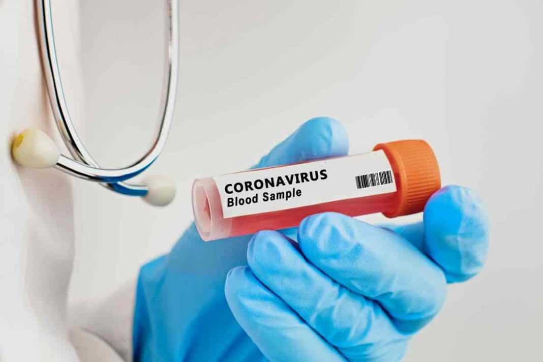 virus