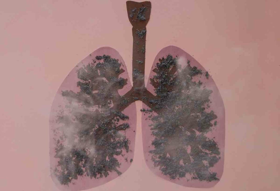 Lung cancer