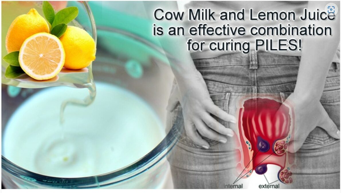 Fact Check Can a mixture of Lemon and Milk cure Piles? THIP Media