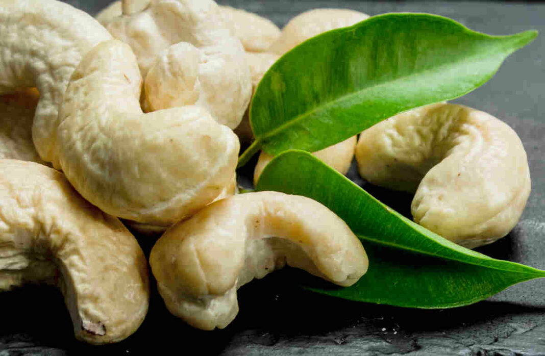 cashews can treat migraines