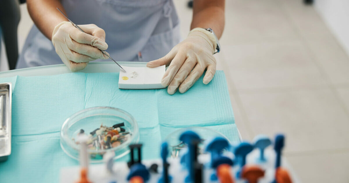 Fact Check Are silver dental fillings harmful? THIP Media