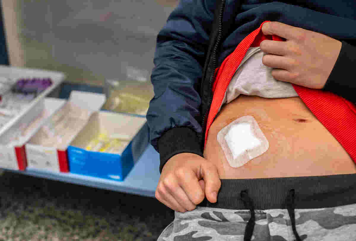 What are the postoperative for appendectomy? THIP Media