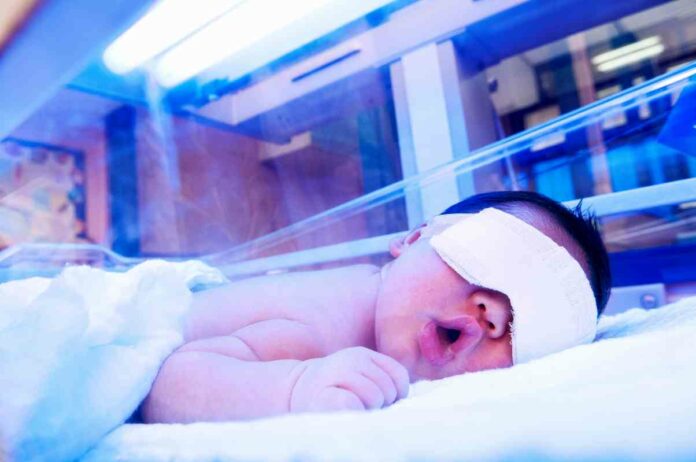 Newborn Jaundice