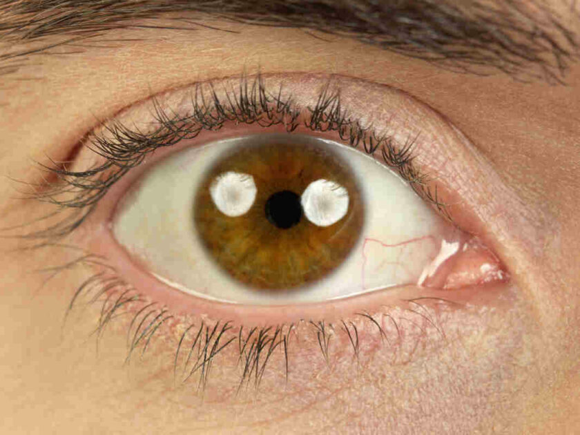 Are eye floaters dangerous?