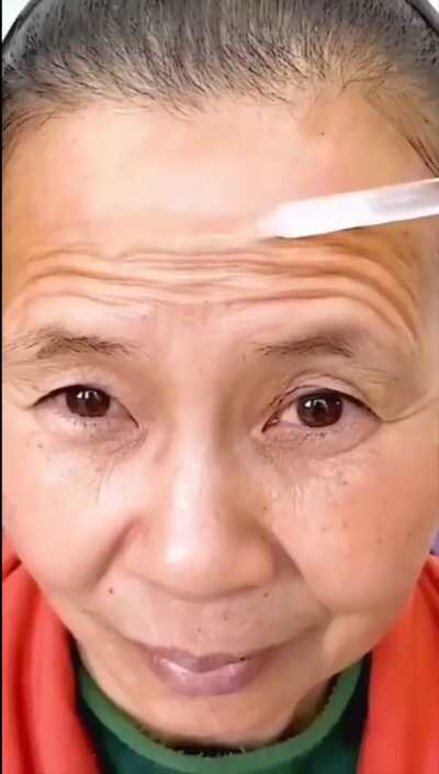 Botox serum remove wrinkles instantly