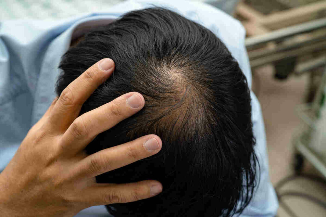 Jaborandi and Arnica