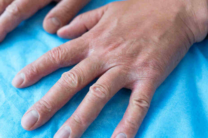 Nail Care Serum can fix all nail problems