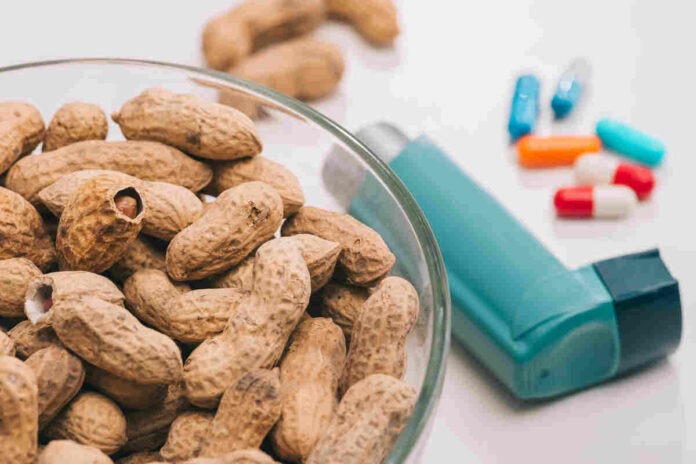 peanut allergy