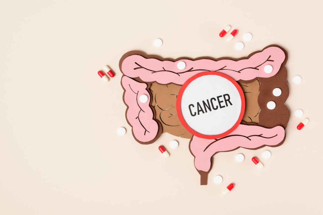 Sambar can prevent colon cancer
