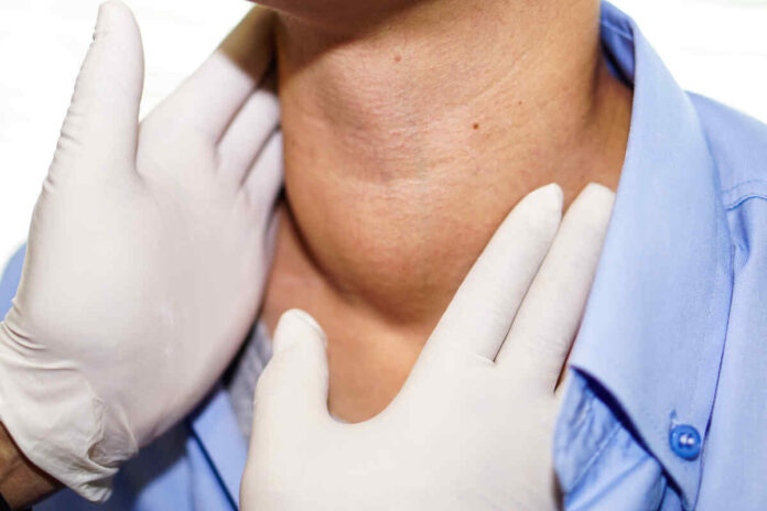 thyroid and menopausal symptoms