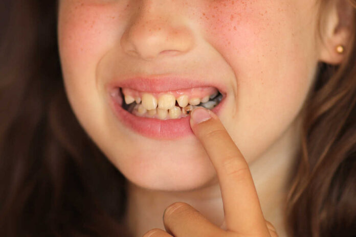 Kids tooth