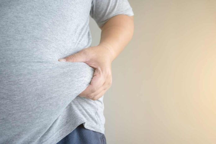 obesity and colon cancer