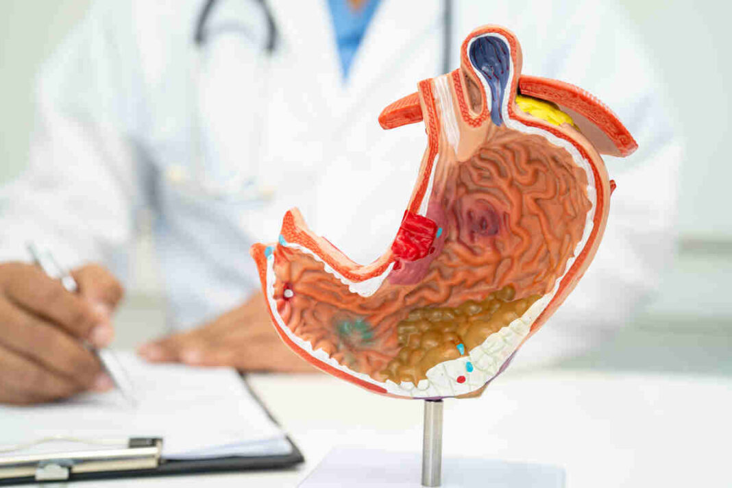 stomach infection