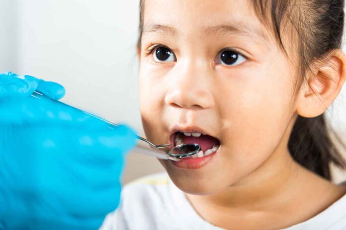 cavities in children