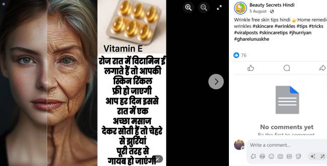 vitamin E for wrinkles