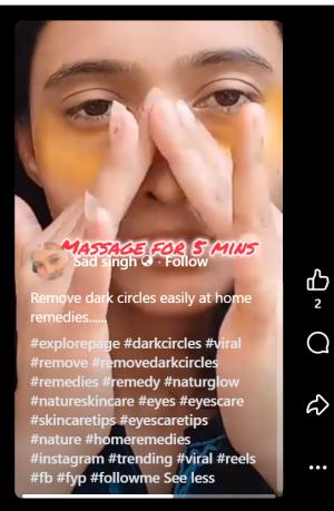 turmeric and dark circles
