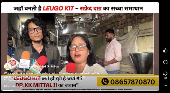 online product for Vitiligo