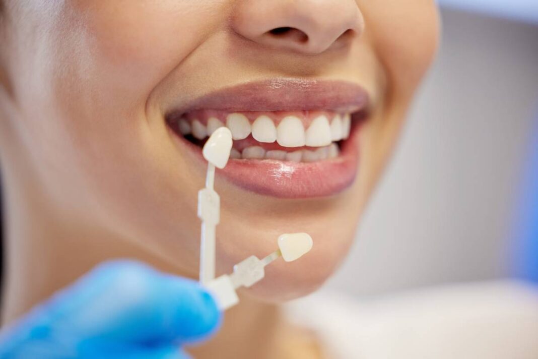 whiten teeth in three days