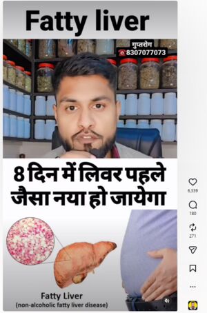 fatty liver can be cured claim