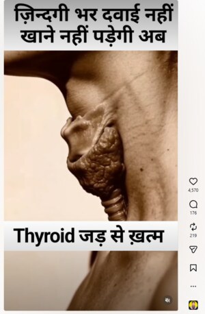 Thyroid can be cured