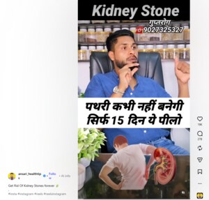 Kidney Stone claim