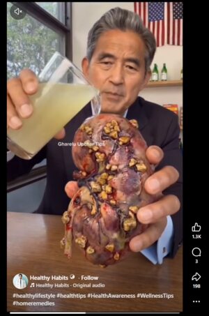 dissolve kidney stones